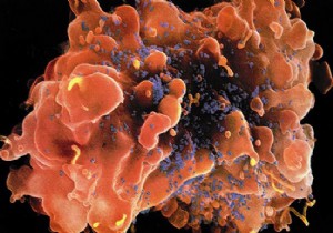 37 Milyon Kişi HIV Virüsü Taşıyor..!