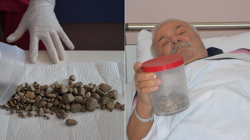 Mesanesinden binlerce taş çıktı!