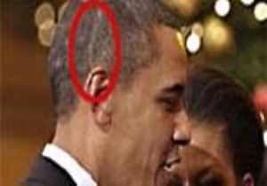 Obama nın Başındaki İzlerin Sırrı Ne?
