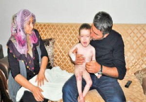 Ali nin el ve ayakları mum gibi eriyor!