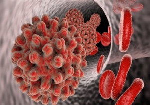 Hepatit B AİDS’ten 100 Kat Daha Bulaşıcı..!
