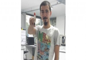 İlk Türk  Yorgunluk Hastası  Olan Ahmet İyileşti!