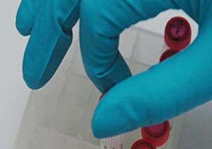 Türkiye’de Doping Patladı Mı?