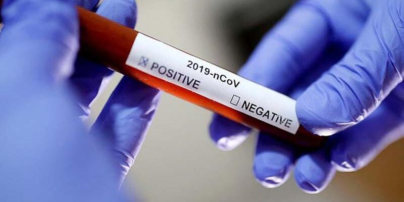Koronavirüste can kaybı 2706 ya yükseldi