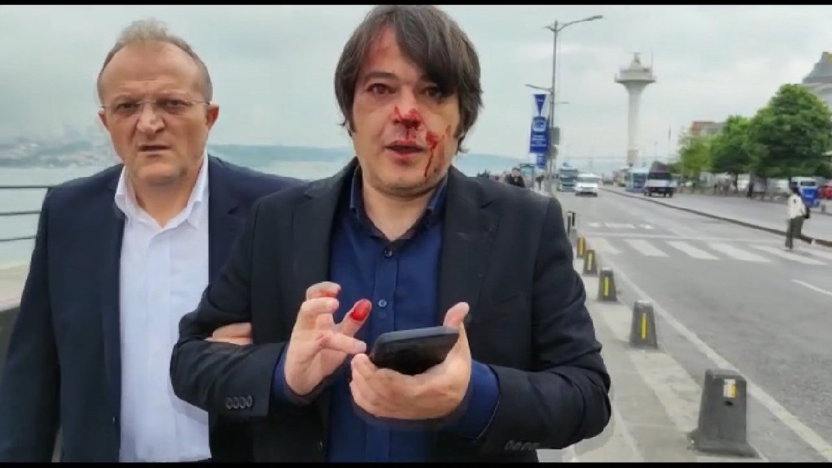 İBB ekiplerine saldırıda 3 gözaltı