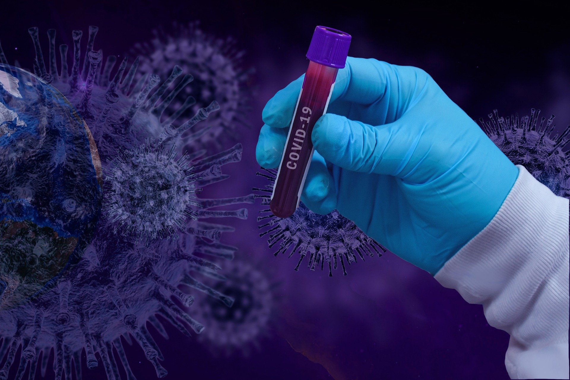 İtalya da koronavirüs kaynaklı can kaybı 28 bin 236 ya yükseldi