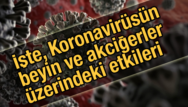 İşte, koronavirüsün beyin ve akciğerler üzerindeki etkileri