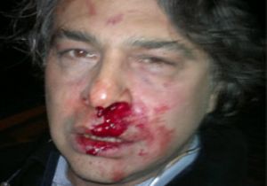 Barbaros Şansal ın Yüzünü Dağıttılar!