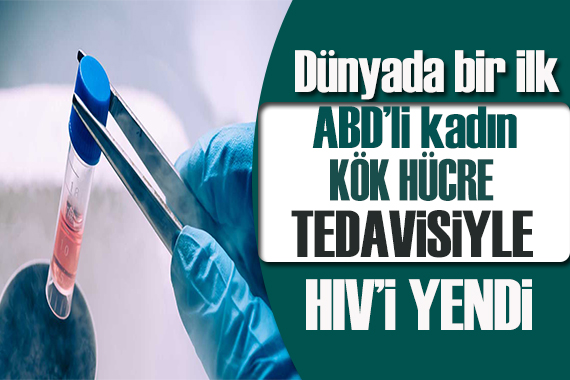 Dünyada ilk kez yaşandı : ABD’li kadın  kök hücre tedavisiyle HIV’i yendi