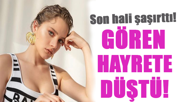 Miray Daner in son hali şok etti!