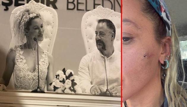 Yıldız Asyalı: 'Eşim tarafından darp edildim'