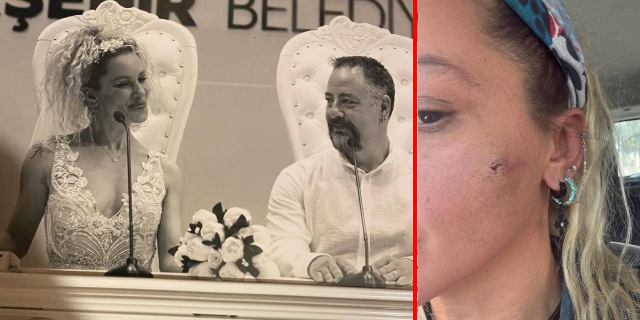 Yıldız Asyalı:  Eşim tarafından darp edildim 