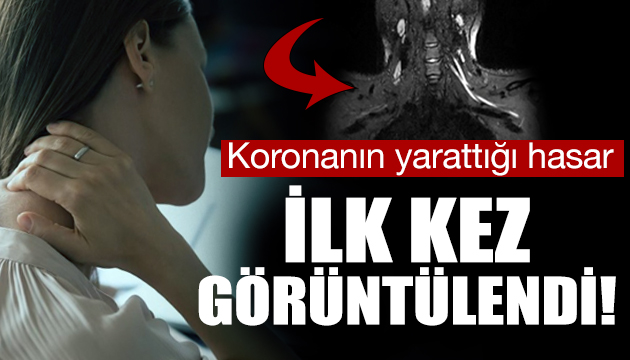 Koronanın yarattığı hasar ilk kez görüntülendi