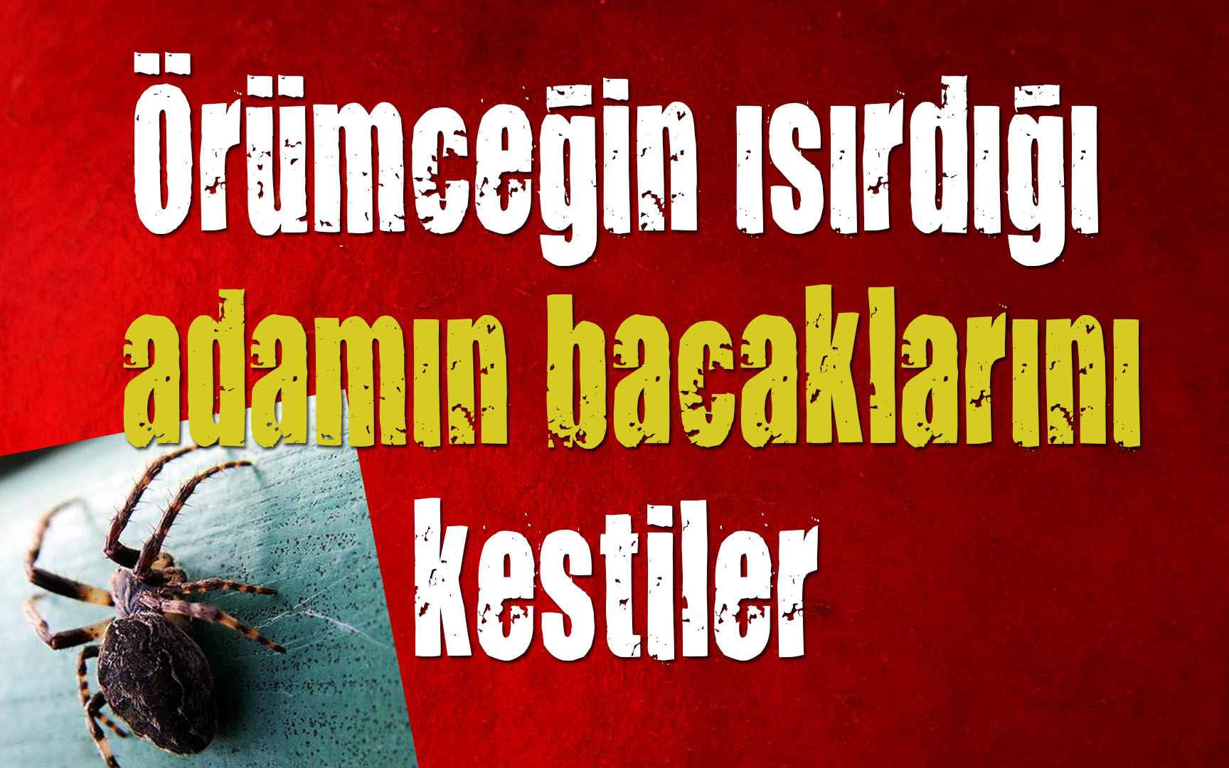 Örümceğin ısırdığı adamın bacaklarını kestiler