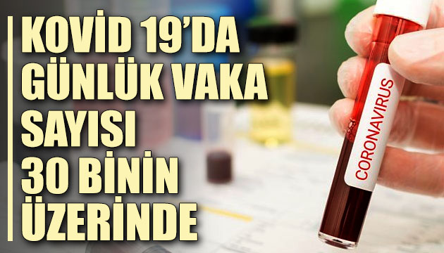 Sağlık Bakanlığı, Kovid 19 da son verileri açıkladı