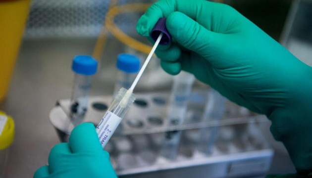 AstraZeneca Kovid -19 aşısının üretimine başlayacak