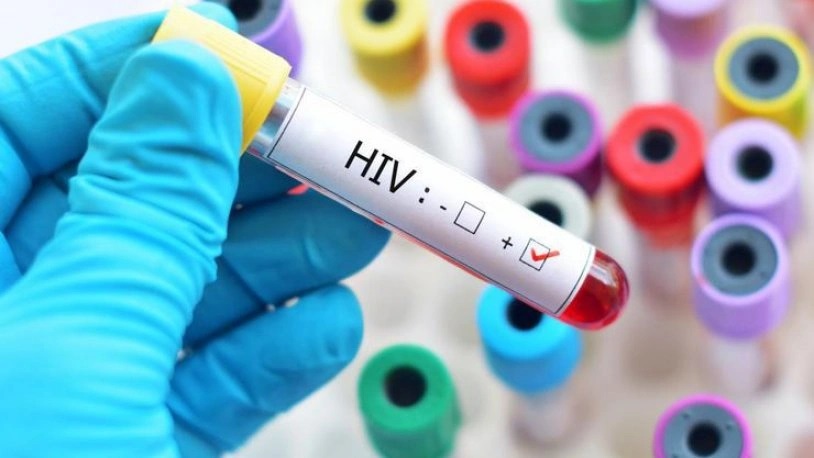 39 milyon kişi de HIV tanısı!