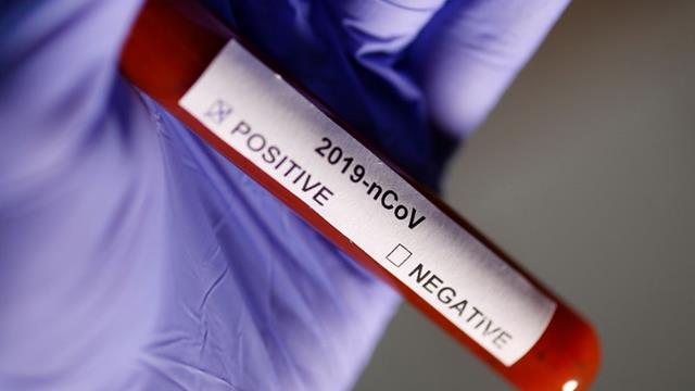ABD de 33 Almanya da 14 yeni koronavirüs vakası tespit edildi