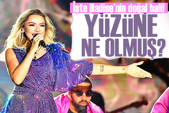 Hadise doğal haliyle sosyal medyayı salladı!