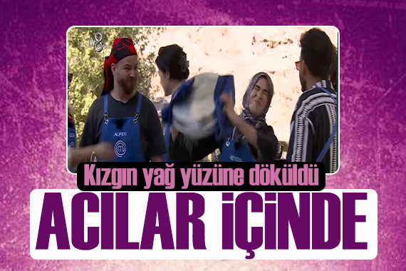 Kızgın yağ yüzüne döküldü! MasterChef Beyza nın yandığı görüntüler yayınlandı!