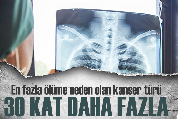 Uzmanından kritik açıklamalar: Her 4 akciğer kanserinin 3 ü sigara ile ilişkili