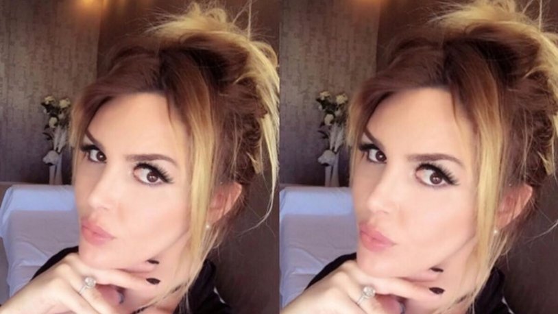 Selin Ciğerci den ameliyat itirafı
