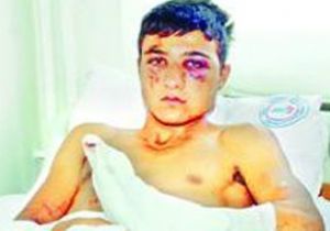 Dayak Zeka Seviyesini Düşürüyor