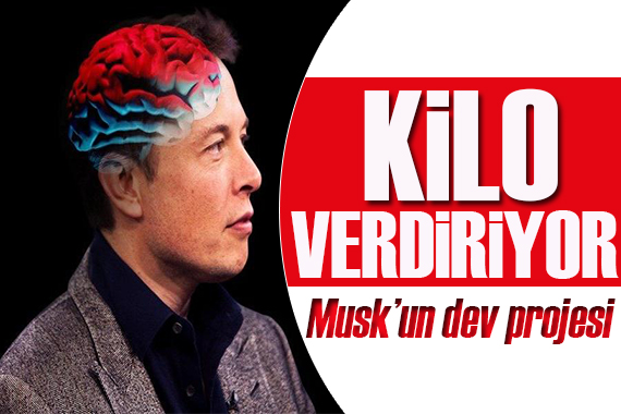 Elon Musk un dev projesi! Bu sayede kilo vereceksiniz!