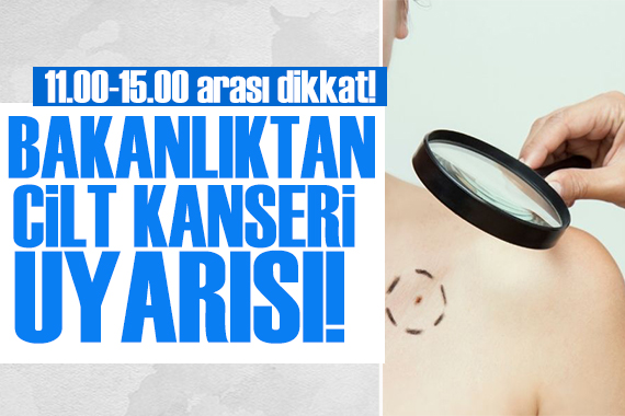 Sağlık Bakanlığı ndan vatandaşlara cilt kanseri uyarısı!