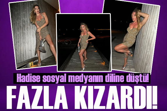 Yaz sezonunu açan Hadise kızarıklığıyla sosyal medyanın diline düştü