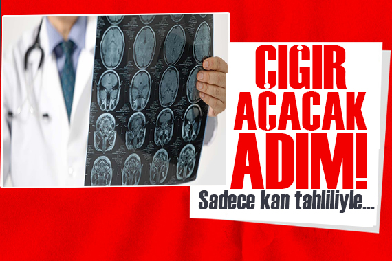 Uzmanı uyardı! Kan tahliliyle beyin tümörü teşhisi