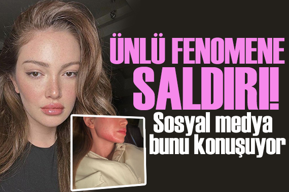 Şiddet iddialarıyla gündeme geldi! Danla Bilic e saldırı!