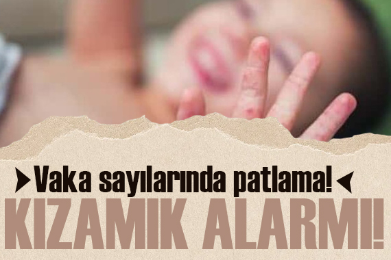 Vaka sayılarında patlama! Avrupa da kızamık ve boğmaca alarmı