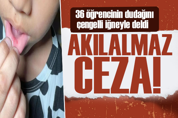 Öğretmenden akılalmaz ceza! 36 öğrencinin dudağını çengelli iğneyle deldi