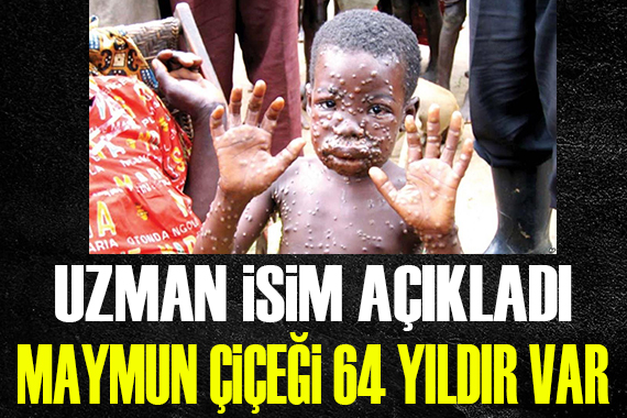 Uzman isim açıkladı: 64 yıldır maymun çiçeği var