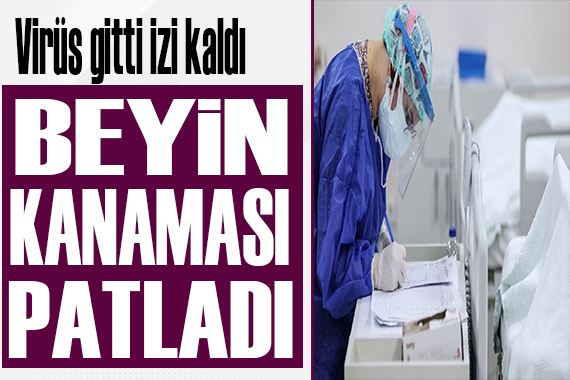 Virüs gitti izi kaldı! Beyin kanaması patladı