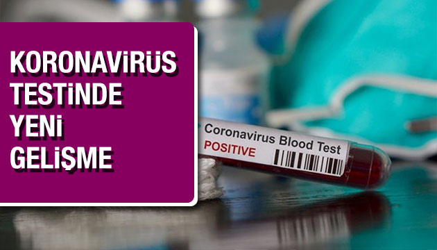 Koronavirüs testiyle ilgili yeni gelişme