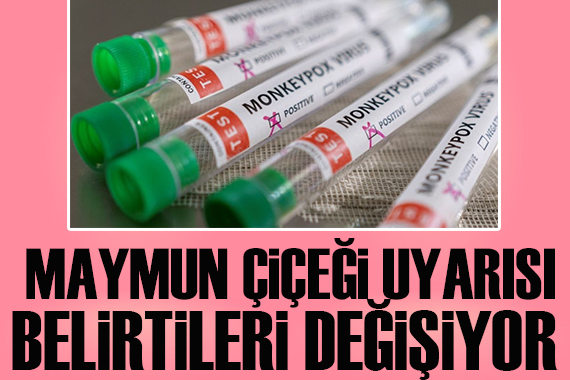 Maymun çiçeği uyarısı! Belirtileri değişiyor