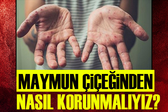 Uzman isim açıkladı! Maymun çiçeğinden nasıl korunmalıyız?