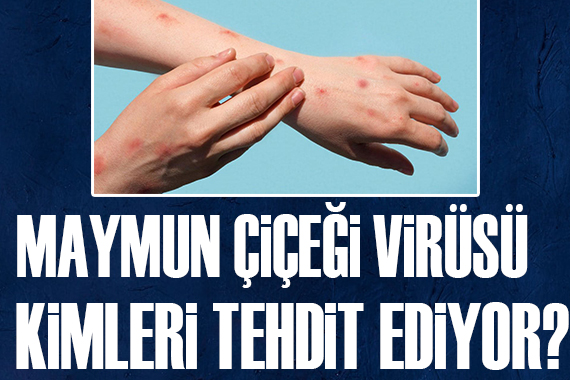 Maymun çiçeği virüsü kimleri tehdit ediyor?