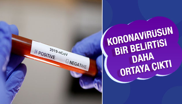 Koronavirüsün bir belirtisi daha ortaya çıktı