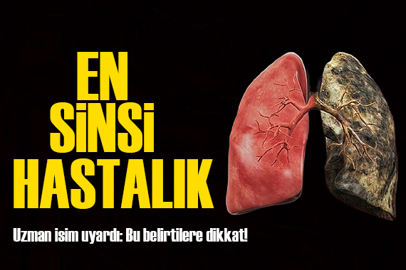 Prof. Dr. Atilla Eroğlu akciğer kanserine ilişkin açıklama yaptı