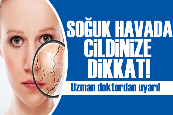 Uzmanı açıkladı: Soğuk hava cilt hastalıklarını artırıyor