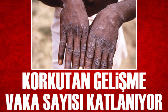 Korkutan gelişme: Vaka sayısı katlanıyor