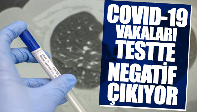 Covid-19 vakaları neden testte çıkmıyor?