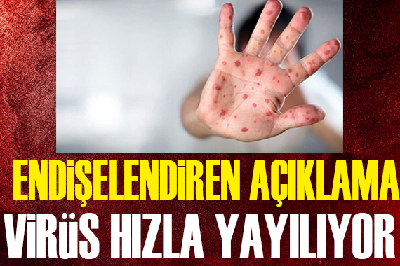 Korkutan açıklama! Virüs hızla yayılıyor