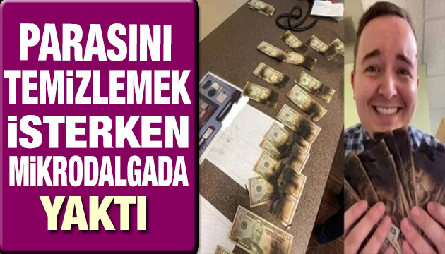 Parasını temizlemek isterken mikrodalgada yaktı