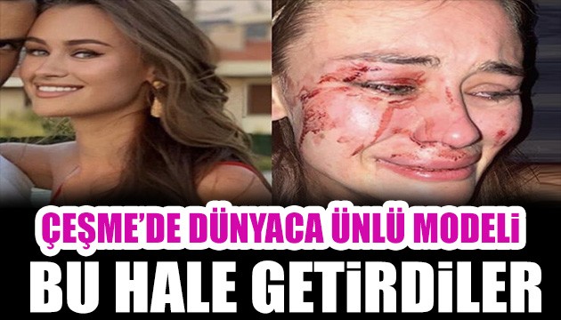 Dünyaca ünlü Çeşme'de güvenlik görevlilerinin saldırısına uğradı