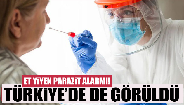 Et yiyen parazit Türkiye de de görüldü