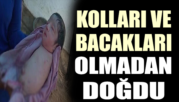 Görenler inanamıyor! Kolları ve bacakları olmadan doğdu